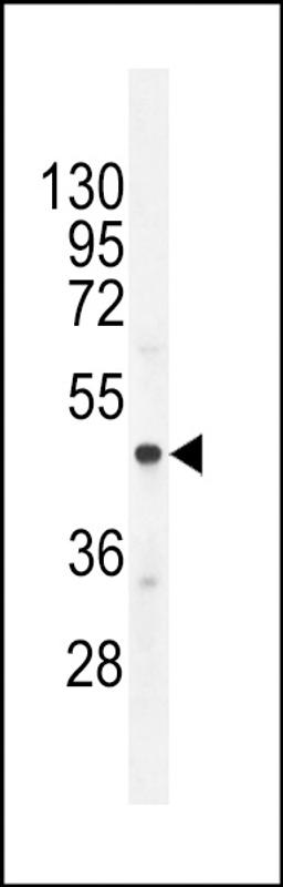 Western blot analysis in A549 cell line lysates (35ug/lane).