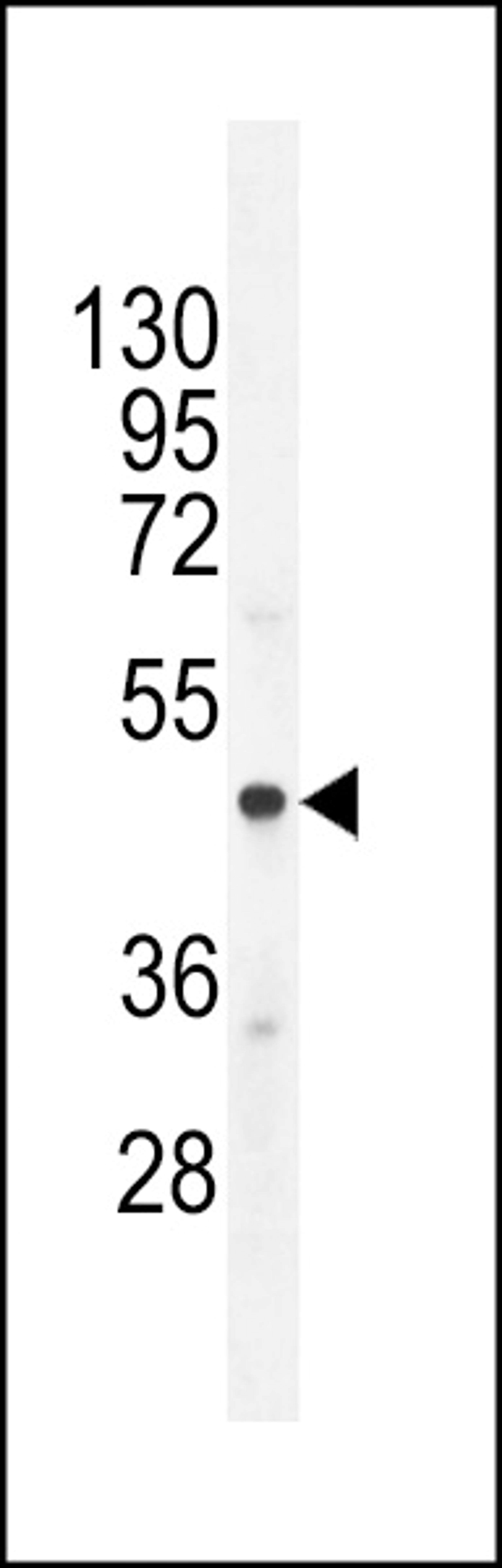 Western blot analysis in A549 cell line lysates (35ug/lane).