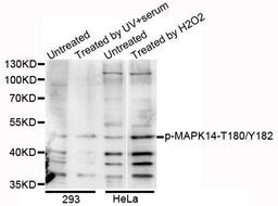 Western blot analysis of extracts of various cell lines using MAPK14 (Phospho--T180/Y182) antibody