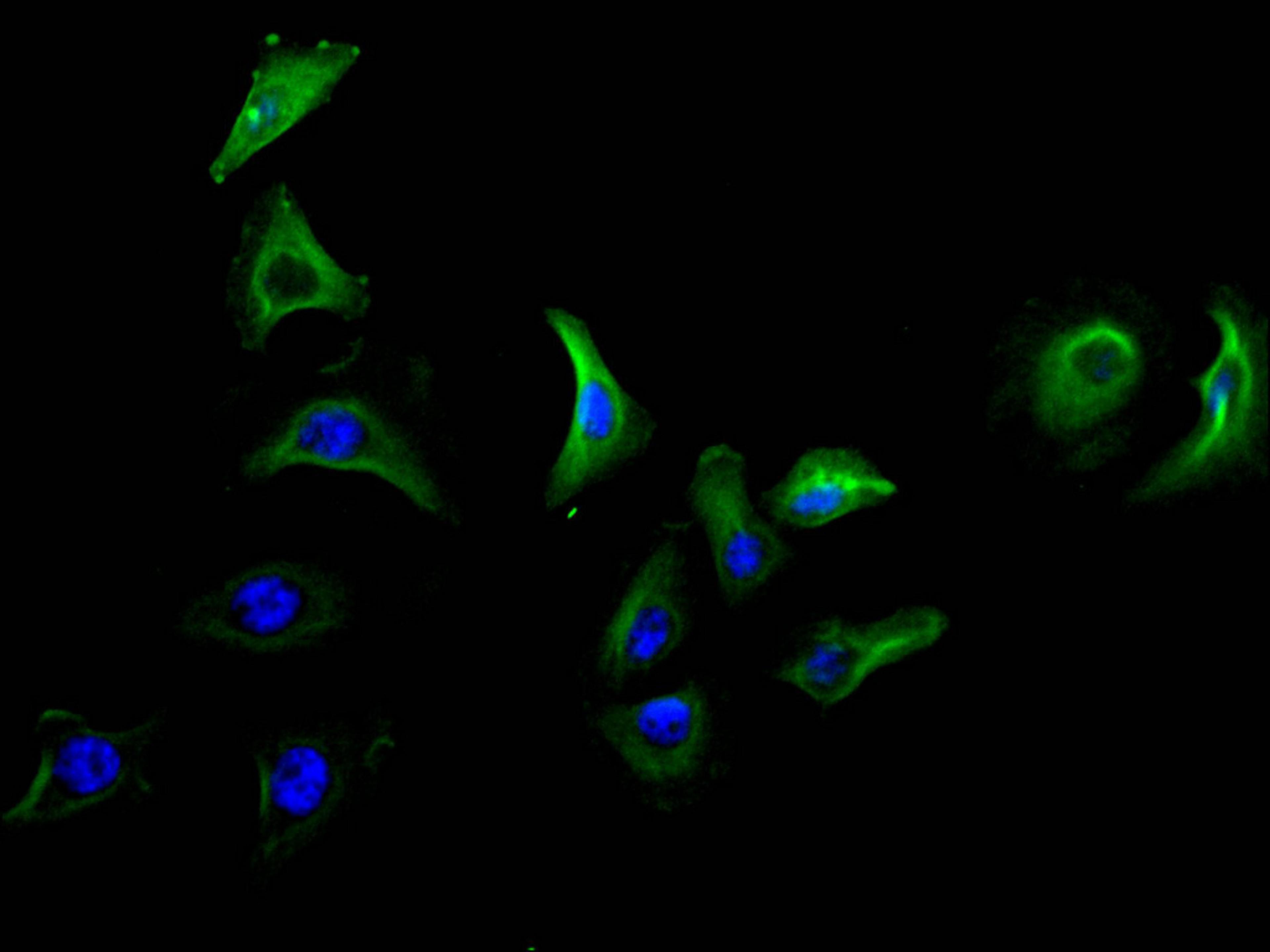 Immunofluorescence staining of A549 cell with CSB-RA619076MA1HU at 1:50, counter-stained with DAPI. The cells were fixed in 4% formaldehyde and blocked in 10% normal Goat Serum. The cells were then incubated with the antibody overnight at 4C. The secondary antibody was FITC-conjugated AffiniPure Goat Anti-Mouse IgG(H+L).