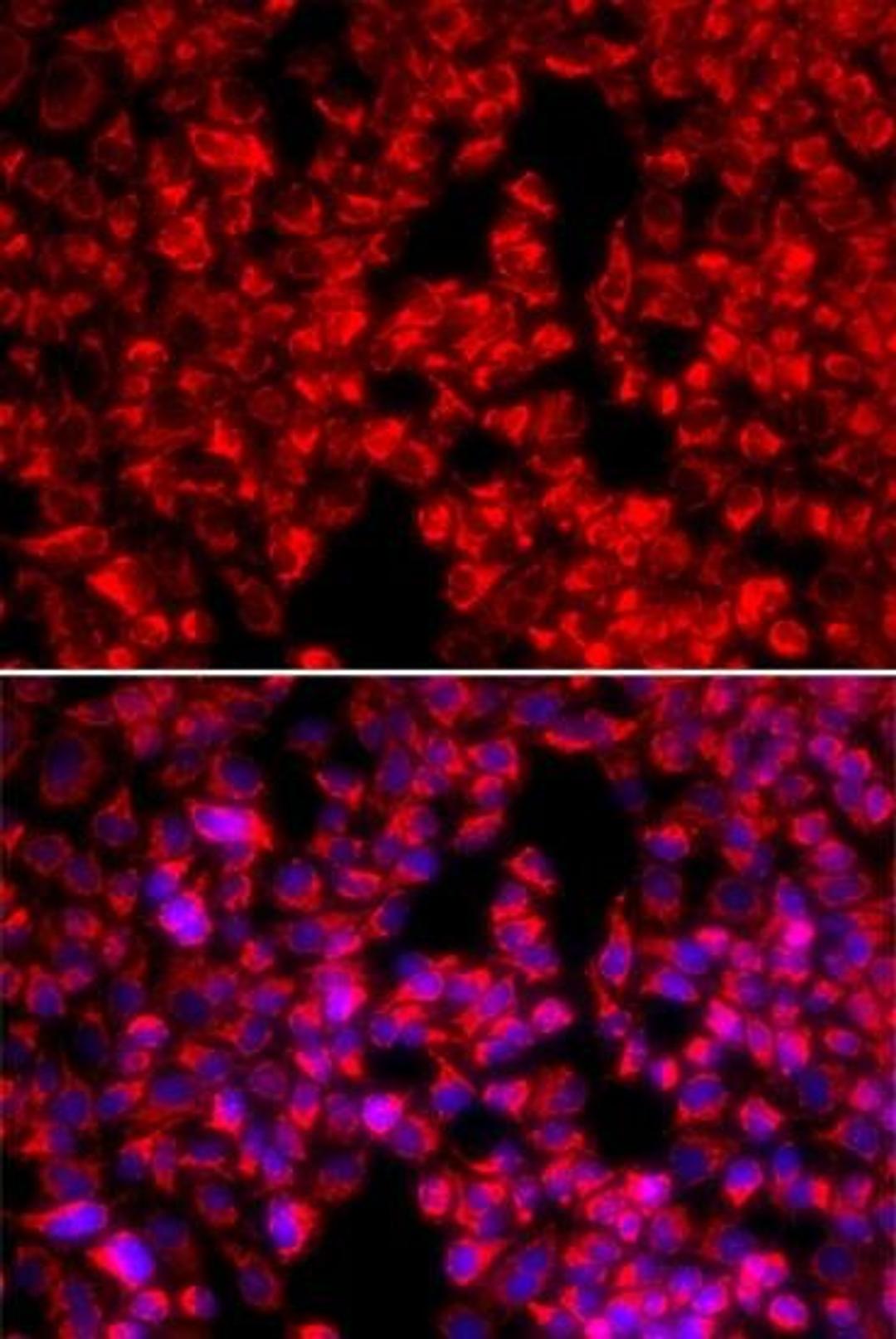 Immunofluorescence analysis of U20S cell using MTTP antibody