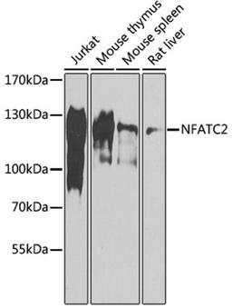 Western blot - NFATC2 antibody (A14189)