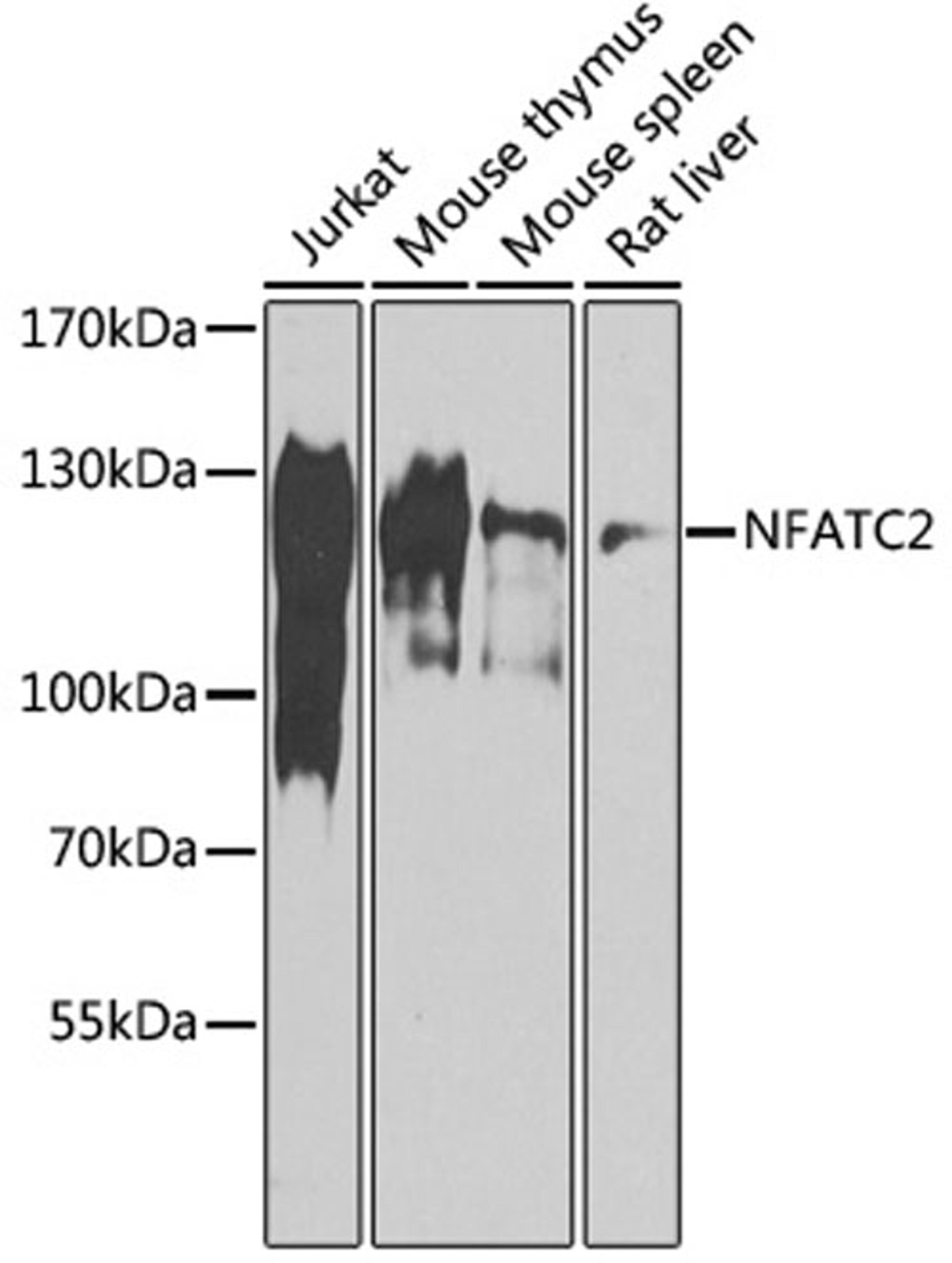 Western blot - NFATC2 antibody (A14189)