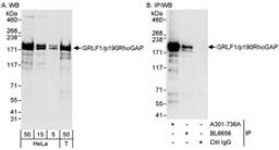 Detection of human GRLF1/p190RhoGAP by western blot and immunoprecipitation.