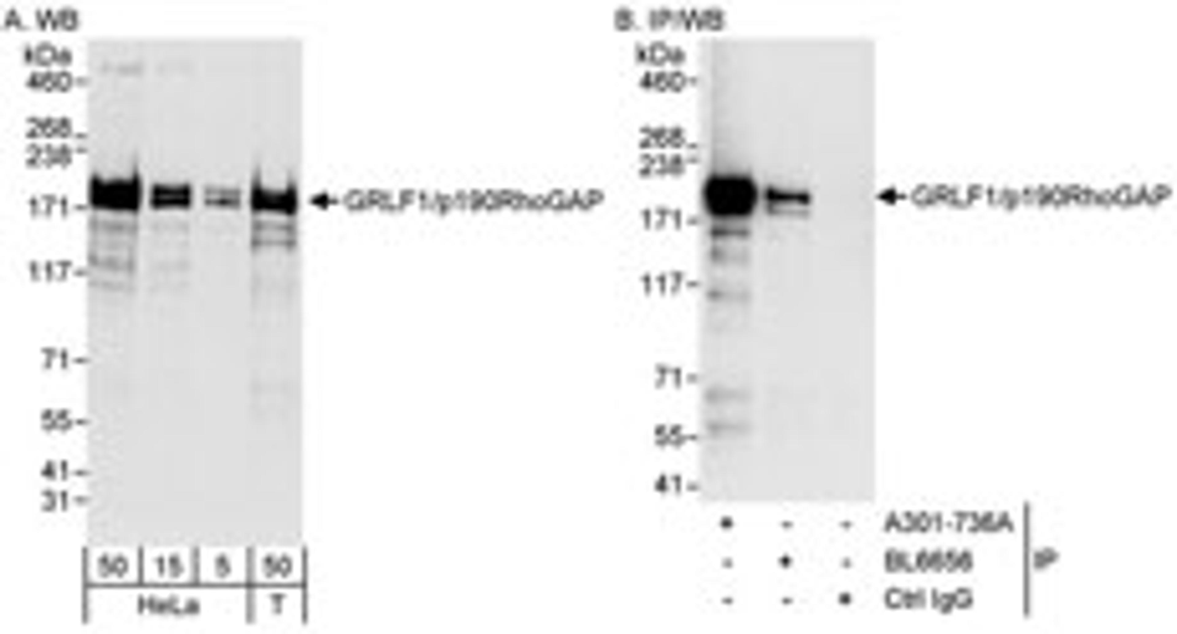 Detection of human GRLF1/p190RhoGAP by western blot and immunoprecipitation.