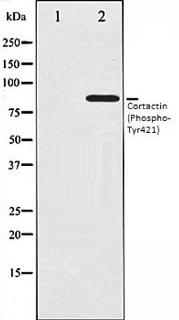 Western blot analysis of HeLa whole cell lysates using Cortactin (Phospho-Tyr421) antibody, The lane on the left is treated with the antigen-specific peptide.