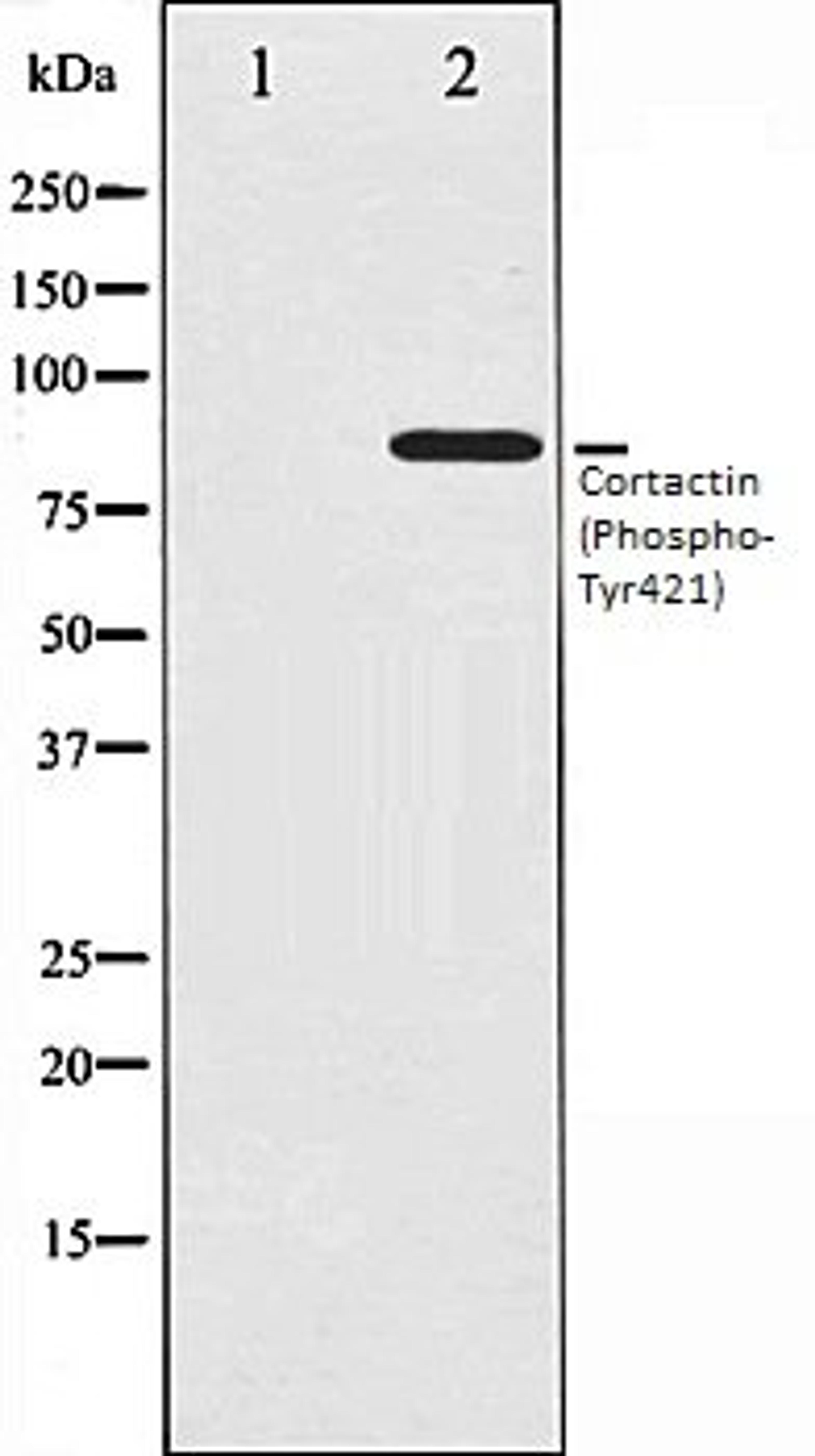 Western blot analysis of HeLa whole cell lysates using Cortactin (Phospho-Tyr421) antibody, The lane on the left is treated with the antigen-specific peptide.