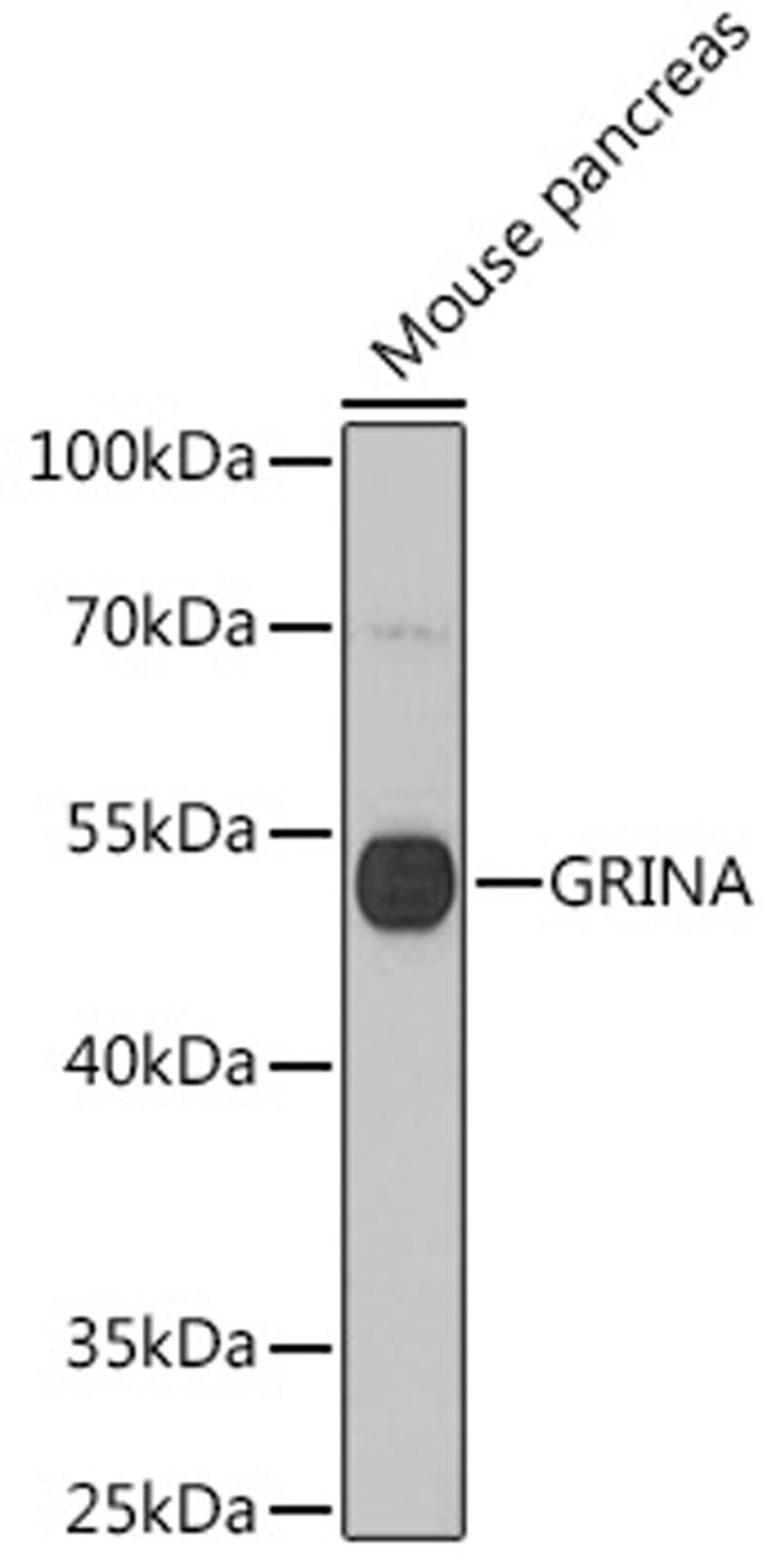 Western blot - GRINA antibody (A16380)