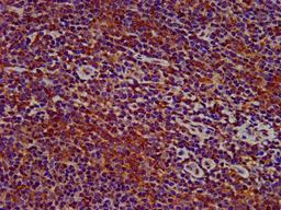 IHC image of CSB-PA842706LA01HU diluted at 1:400 and staining in paraffin-embedded human lymph node tissue performed on a Leica BondTM system. After dewaxing and hydration, antigen retrieval was mediated by high pressure in a citrate buffer (pH 6.0). Section was blocked with 10% normal goat serum 30min at RT. Then primary antibody (1% BSA) was incubated at 4°C overnight. The primary is detected by a biotinylated secondary antibody and visualized using an HRP conjugated SP system.