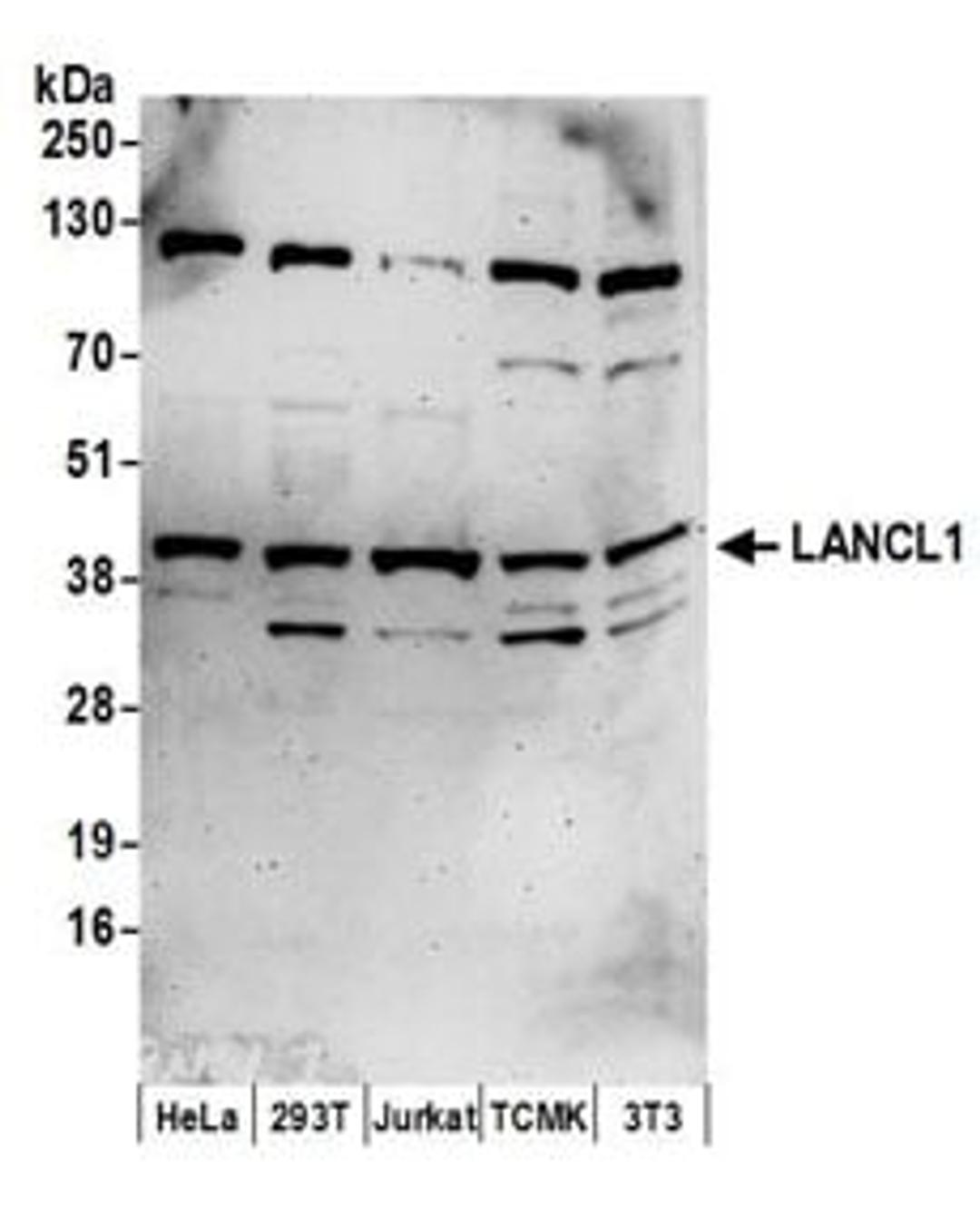 Detection of human and mouse LANCL1 by western blot.