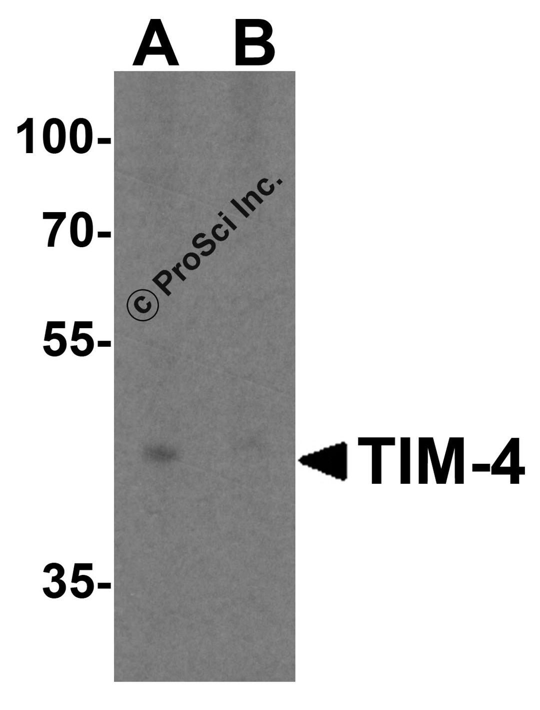 Western blot analysis of TIM-4 in RAW264.7 cell lysate with TIM-4 antibody at 2 μg/mL in (A) the absence and (B) the presence of blocking peptide.