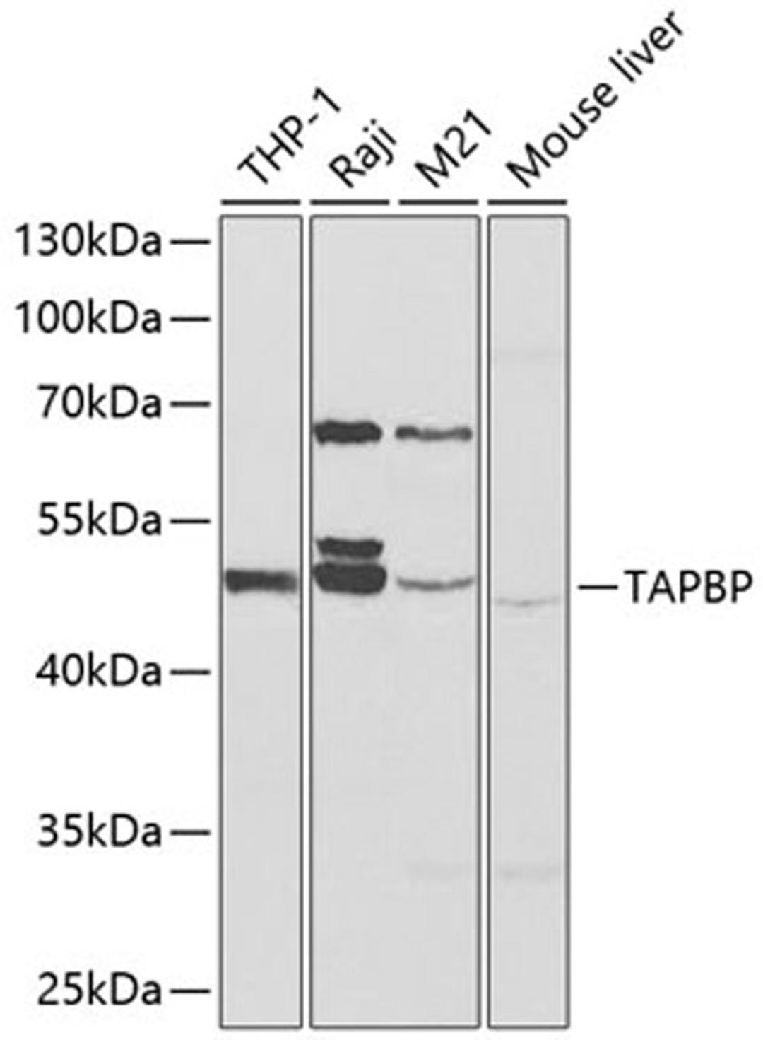 Western blot - TAPBP antibody (A13357)