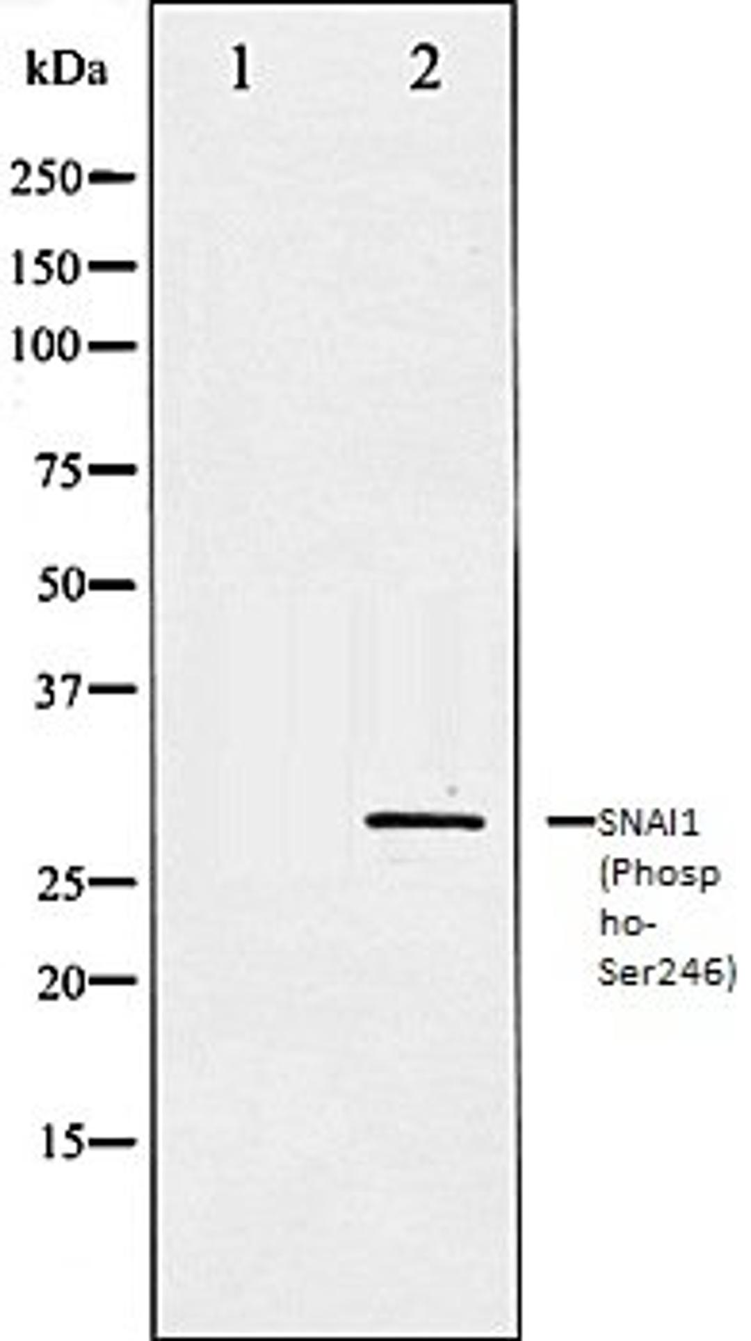 Western blot analysis of HT29 whole cell lysates using SNAI1 (Phospho-Ser246) antibody, The lane on the left is treated with the antigen-specific peptide.