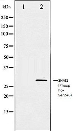 Western blot analysis of HT29 whole cell lysates using SNAI1 (Phospho-Ser246) antibody, The lane on the left is treated with the antigen-specific peptide.