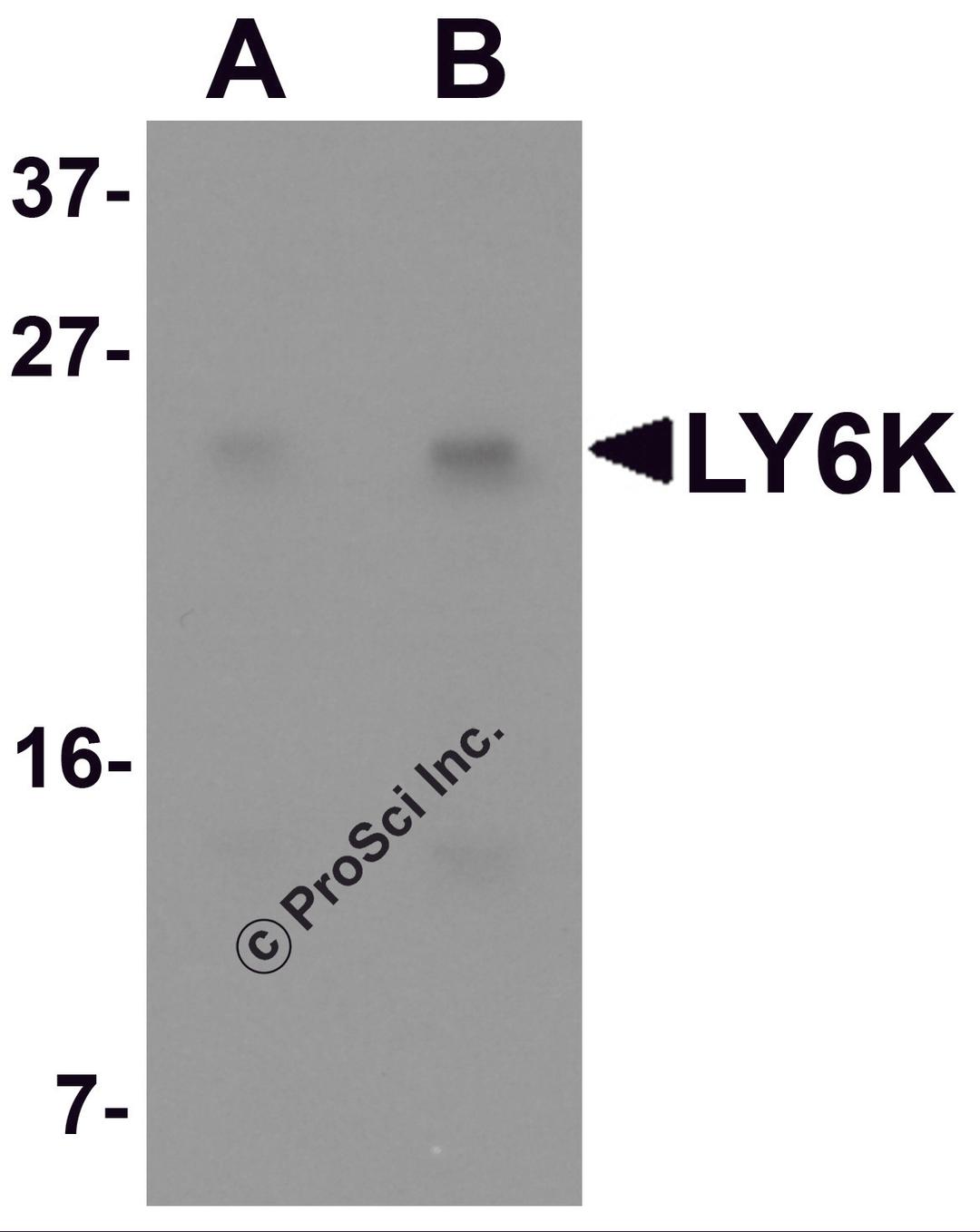 Western blot analysis of LY6K in HeLa cell lysate with LY6K antibody at (A) 1 and (B) 2 &#956;g/mL.