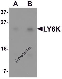 Western blot analysis of LY6K in HeLa cell lysate with LY6K antibody at (A) 1 and (B) 2 &#956;g/mL.