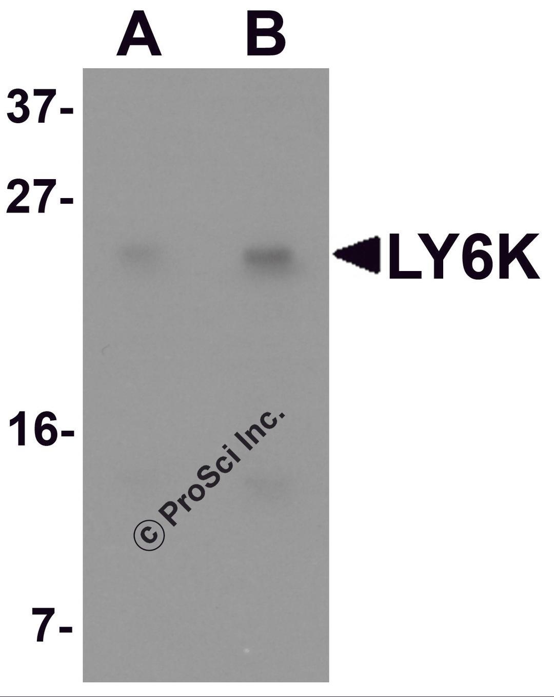 Western blot analysis of LY6K in HeLa cell lysate with LY6K antibody at (A) 1 and (B) 2 μg/mL.