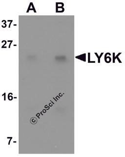 Western blot analysis of LY6K in HeLa cell lysate with LY6K antibody at (A) 1 and (B) 2 μg/mL.