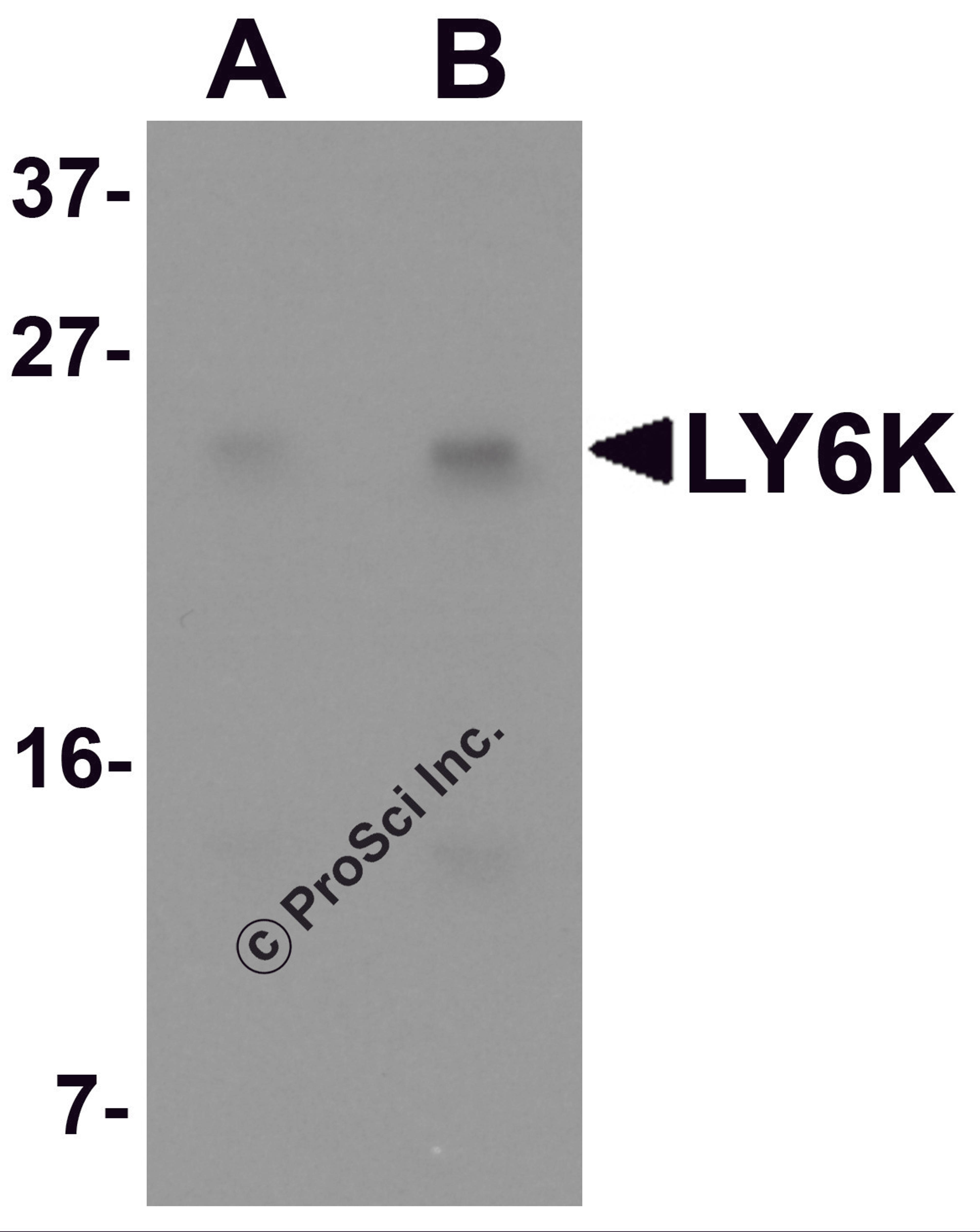 Western blot analysis of LY6K in HeLa cell lysate with LY6K antibody at (A) 1 and (B) 2 μg/mL.