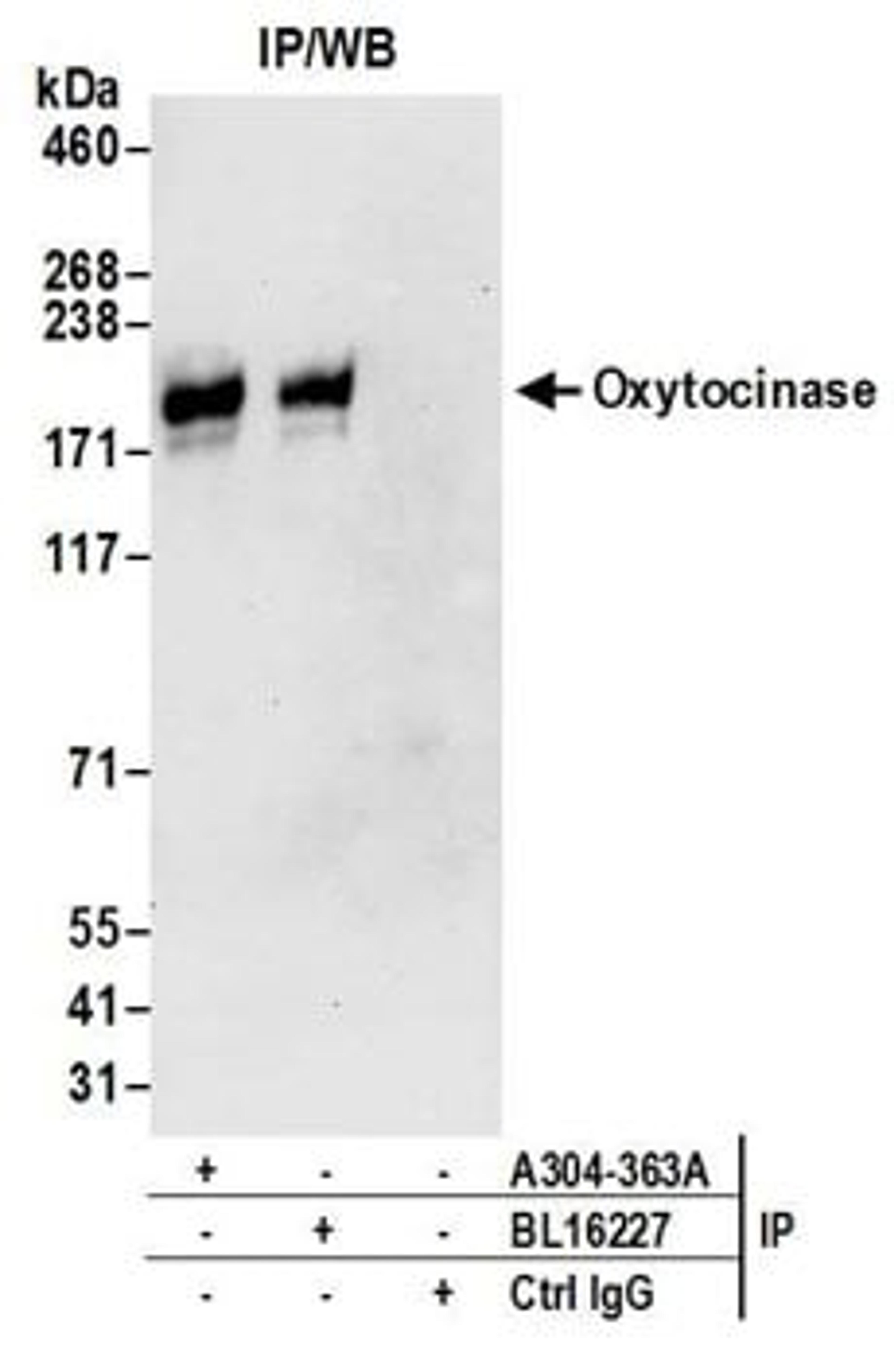 Detection of human Oxytocinase by western blot of immunoprecipitates.