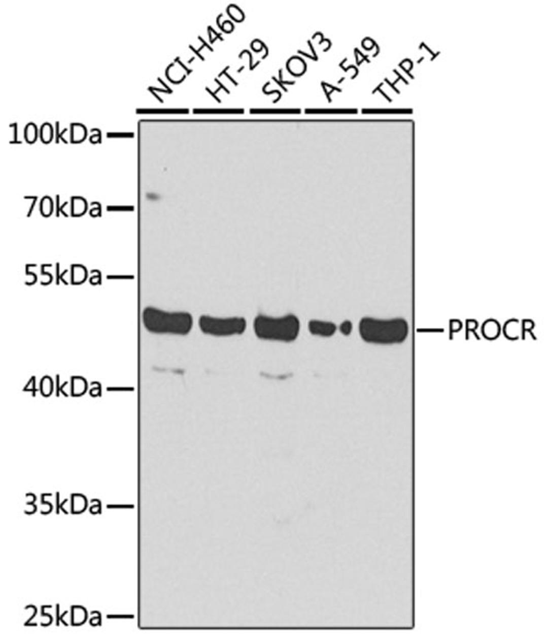 Western blot - PROCR antibody (A13641)