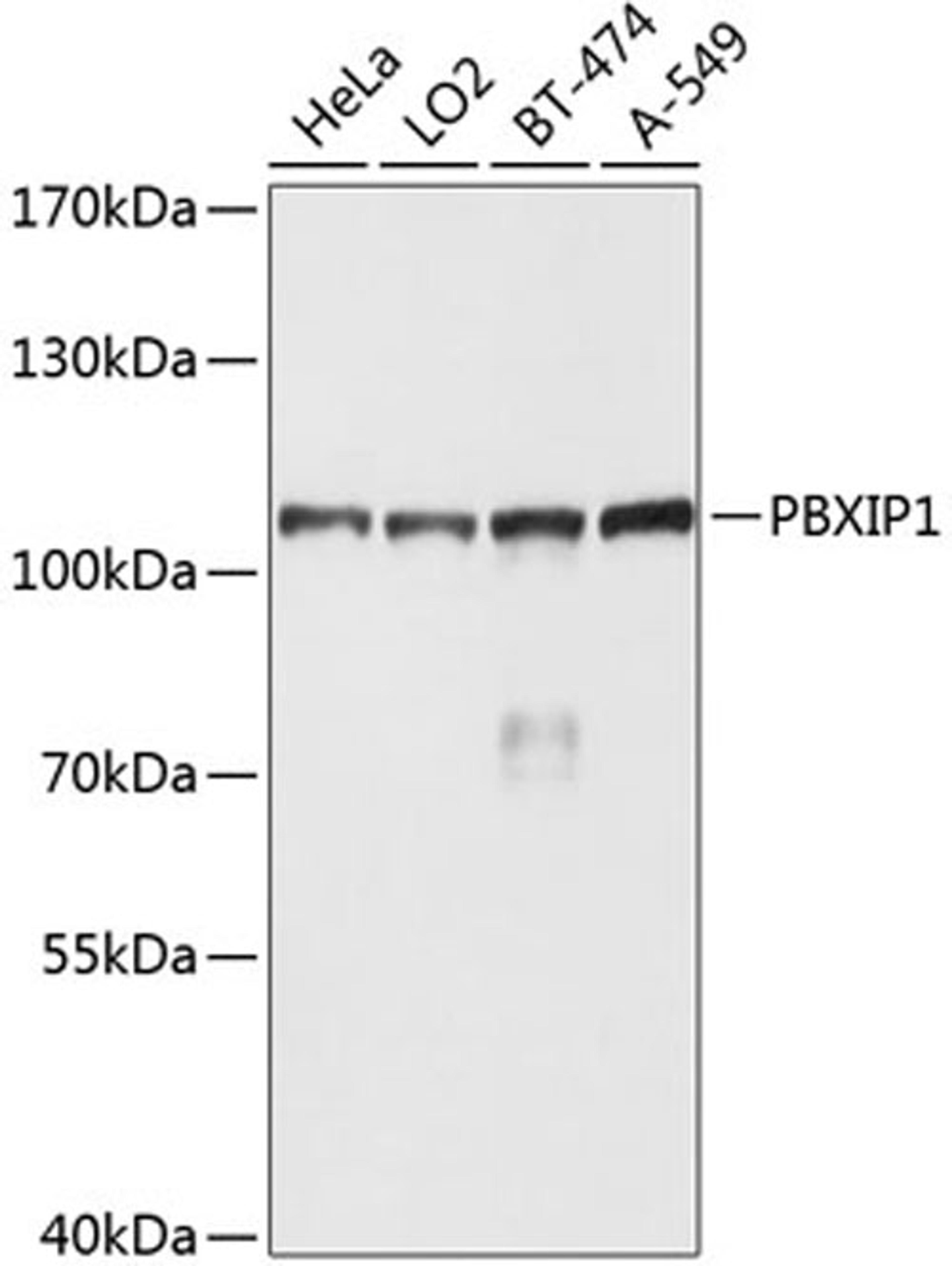 Western blot - PBXIP1 antibody (A8790)