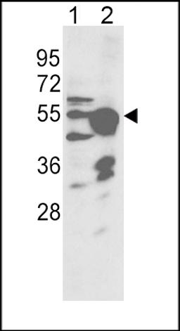 Western blot analysis of CYP2R1 Antibody in NCI-H460 cell line(lane 1) and mouse liver tissue(lane 2) lysates (35ug/lane)