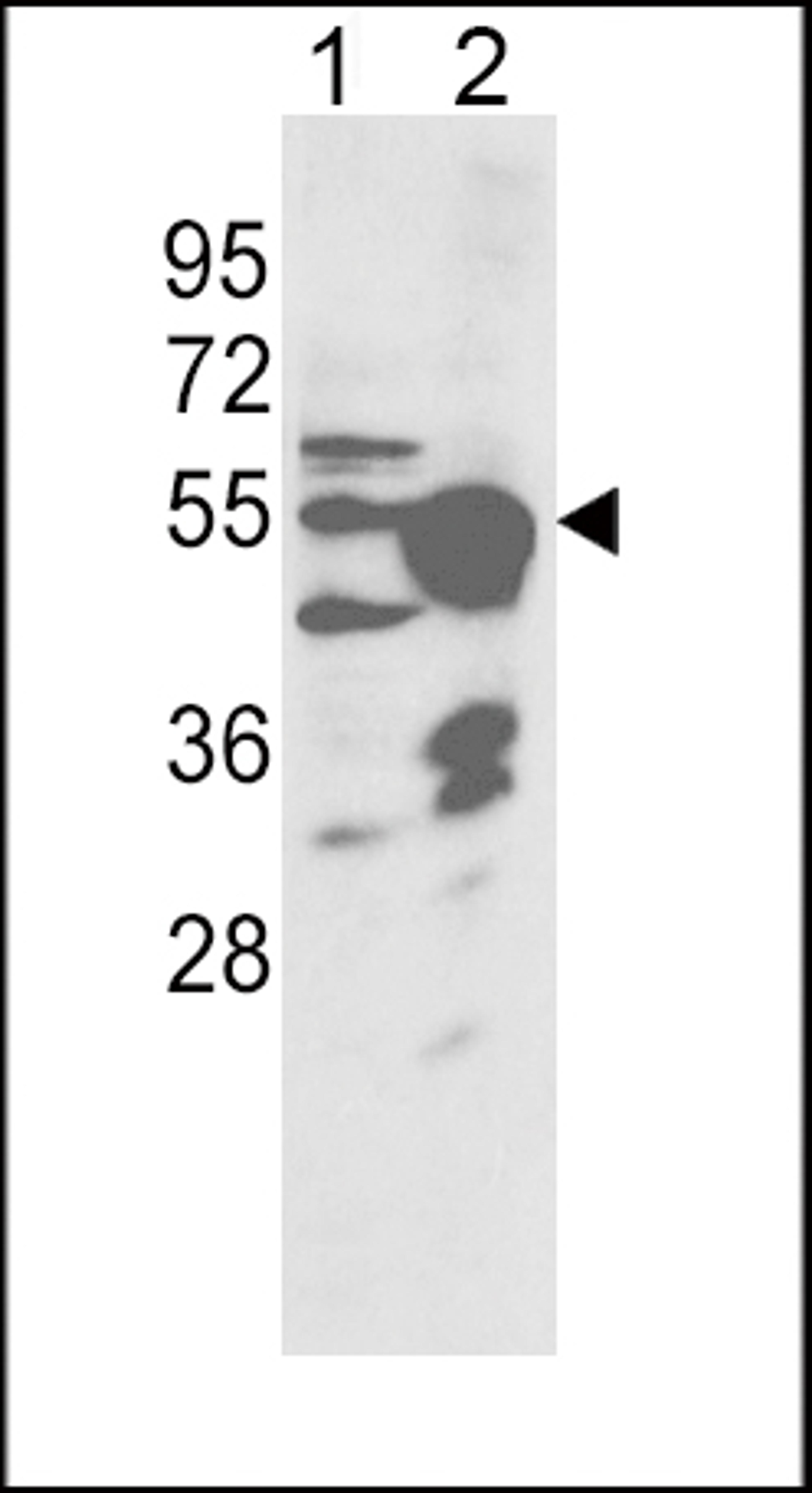 Western blot analysis of CYP2R1 Antibody in NCI-H460 cell line(lane 1) and mouse liver tissue(lane 2) lysates (35ug/lane)