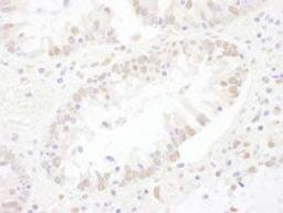 Detection of human SNRNP200 by immunohistochemistry.