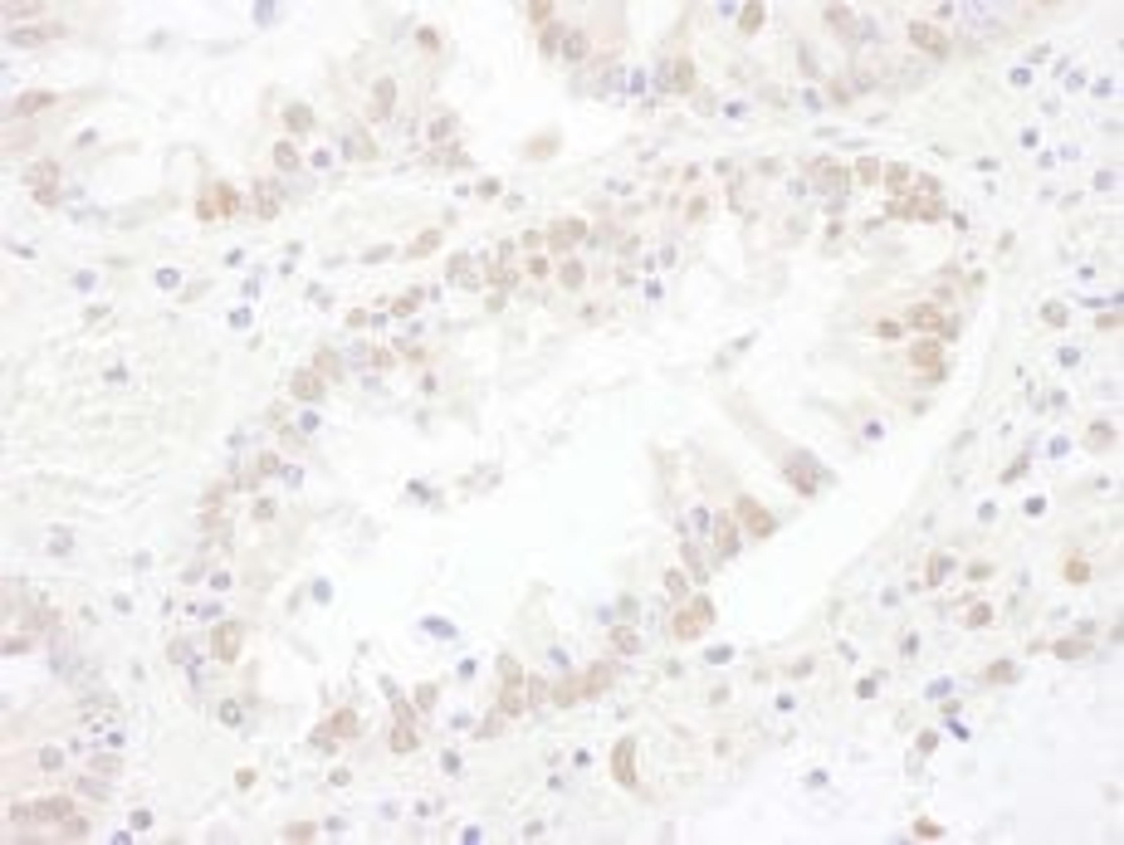 Detection of human SNRNP200 by immunohistochemistry.