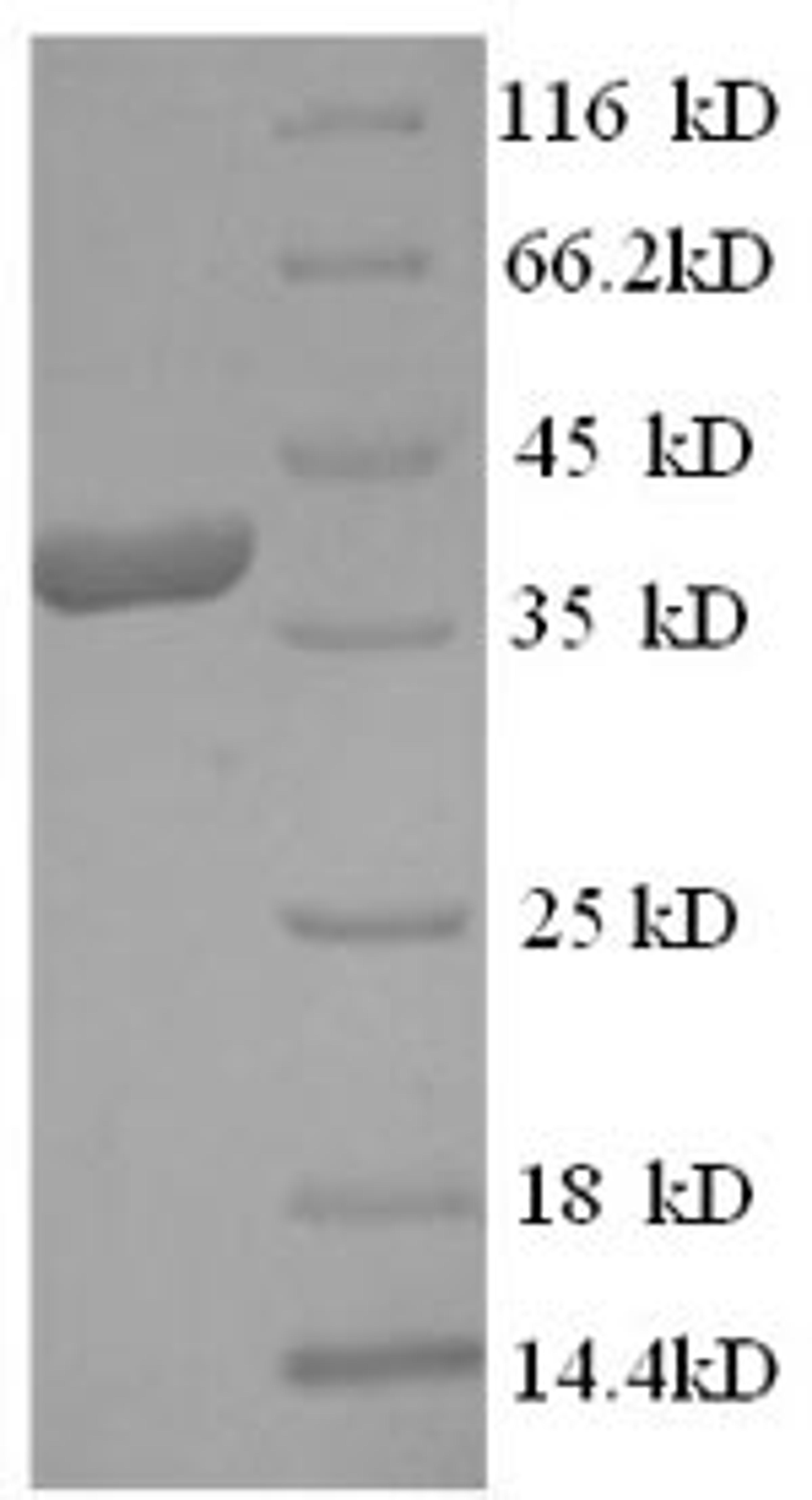 (Tris-Glycine gel) Discontinuous SDS-PAGE (reduced) with 5% enrichment gel and 15% separation gel.