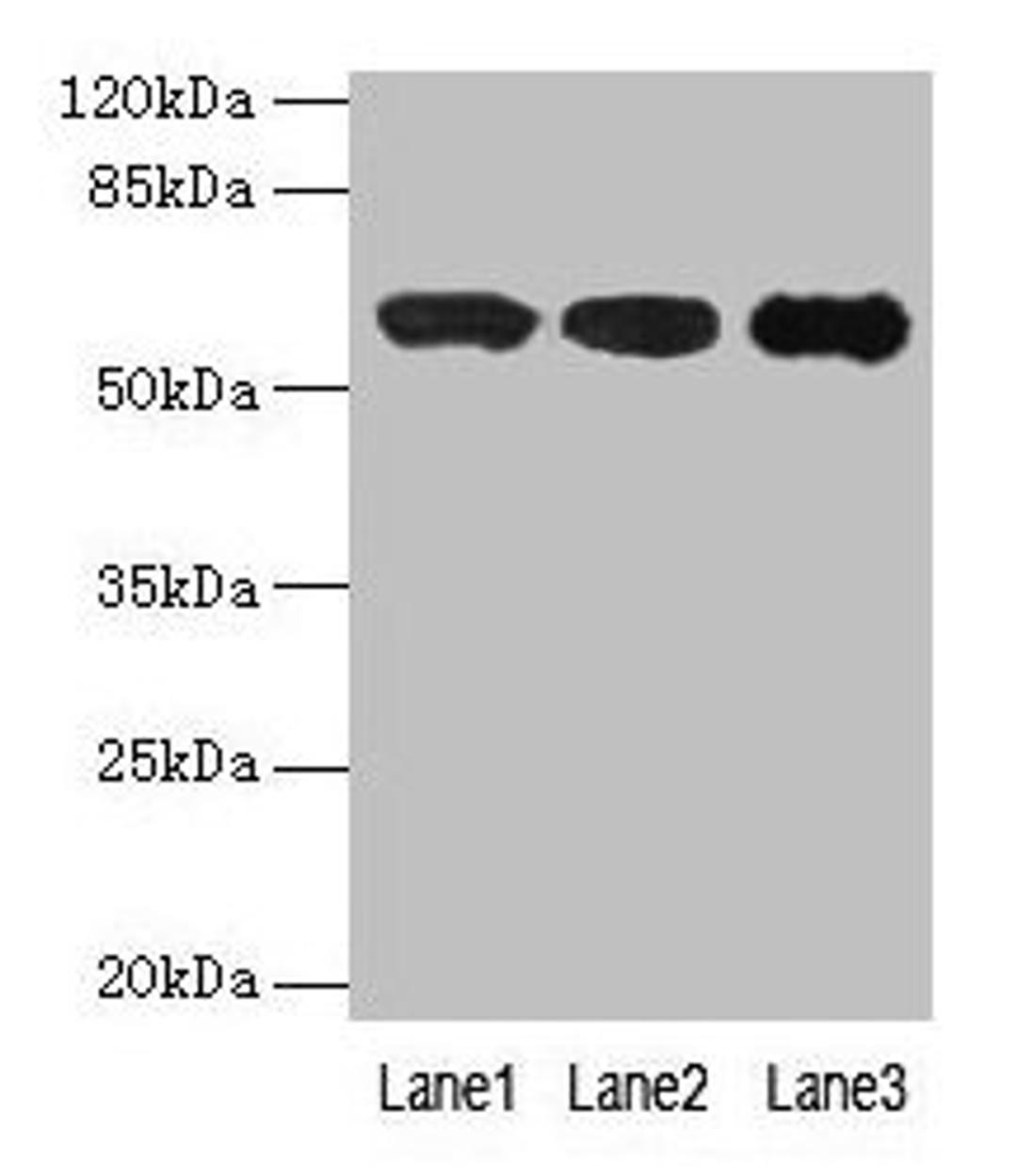 Western blot. All lanes: IMPDH2 antibody at 12µg/ml. Lane 1: Mouse heart tissue. Lane 2: A549 whole cell lysate. Lane 3: Hela whole cell lysate. Secondary. Goat polyclonal to rabbit IgG at 1/10000 dilution. Predicted band size: 56 kDa. Observed band size: 56 kDa