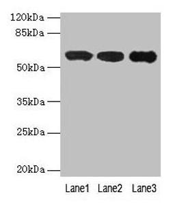 Western blot. All lanes: IMPDH2 antibody at 12µg/ml. Lane 1: Mouse heart tissue. Lane 2: A549 whole cell lysate. Lane 3: Hela whole cell lysate. Secondary. Goat polyclonal to rabbit IgG at 1/10000 dilution. Predicted band size: 56 kDa. Observed band size: 56 kDa