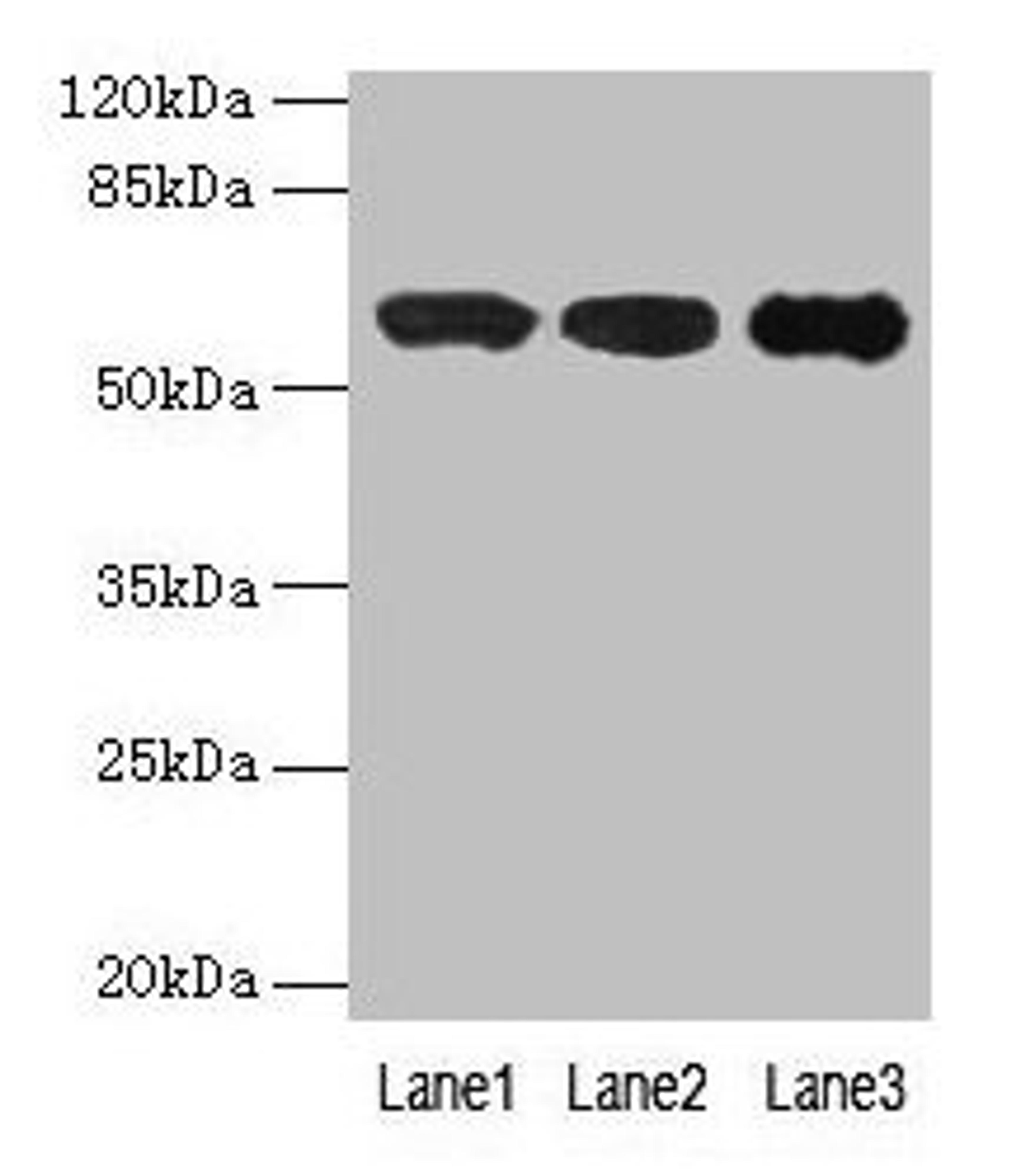 Western blot. All lanes: IMPDH2 antibody at 12µg/ml. Lane 1: Mouse heart tissue. Lane 2: A549 whole cell lysate. Lane 3: Hela whole cell lysate. Secondary. Goat polyclonal to rabbit IgG at 1/10000 dilution. Predicted band size: 56 kDa. Observed band size: 56 kDa