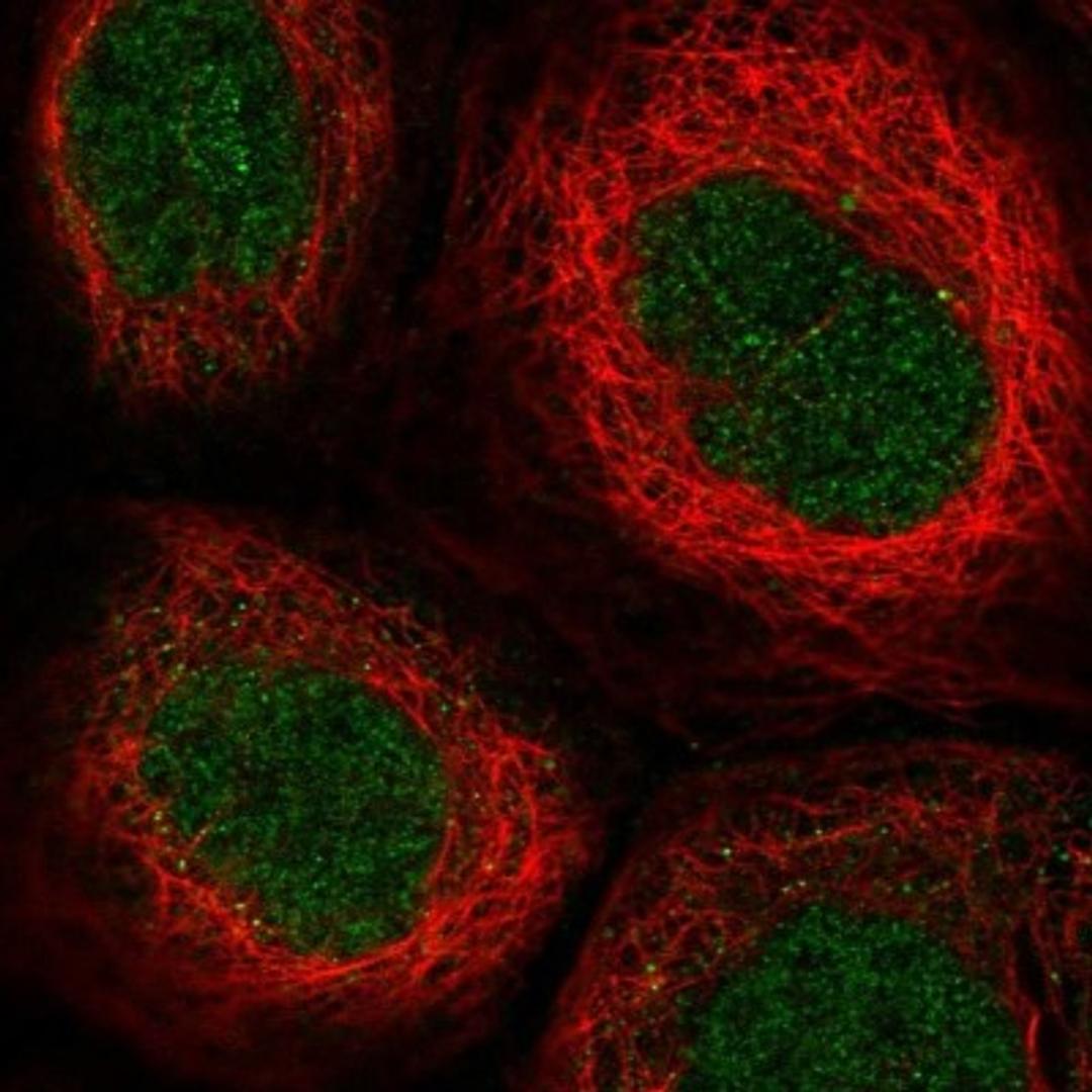 Immunocytochemistry/Immunofluorescence: TTC33 Antibody [NBP1-82468] - Staining of human cell line A-431 shows positivity in nucleus but not nucleoli.