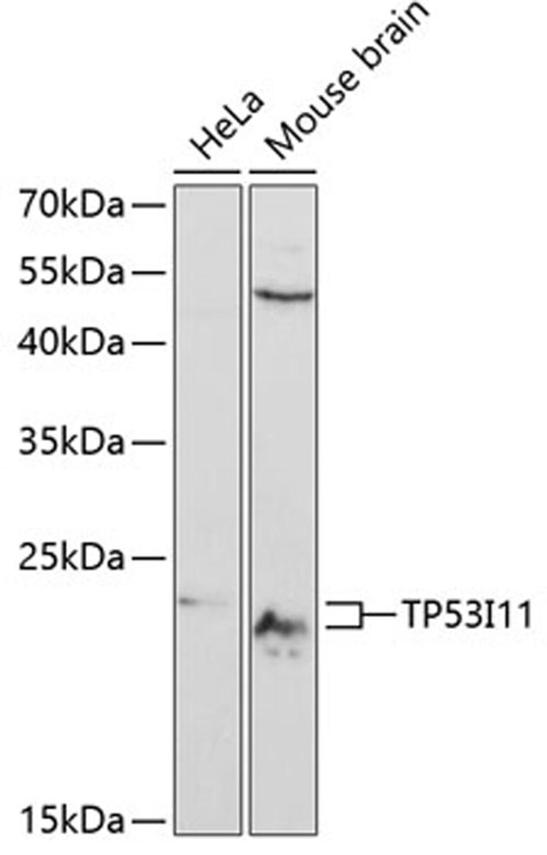 Western blot - TP53I11 antibody (A12855)