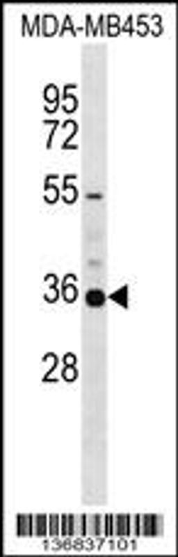 Western blot analysis in MDA-MB453 cell line lysates (35ug/lane).