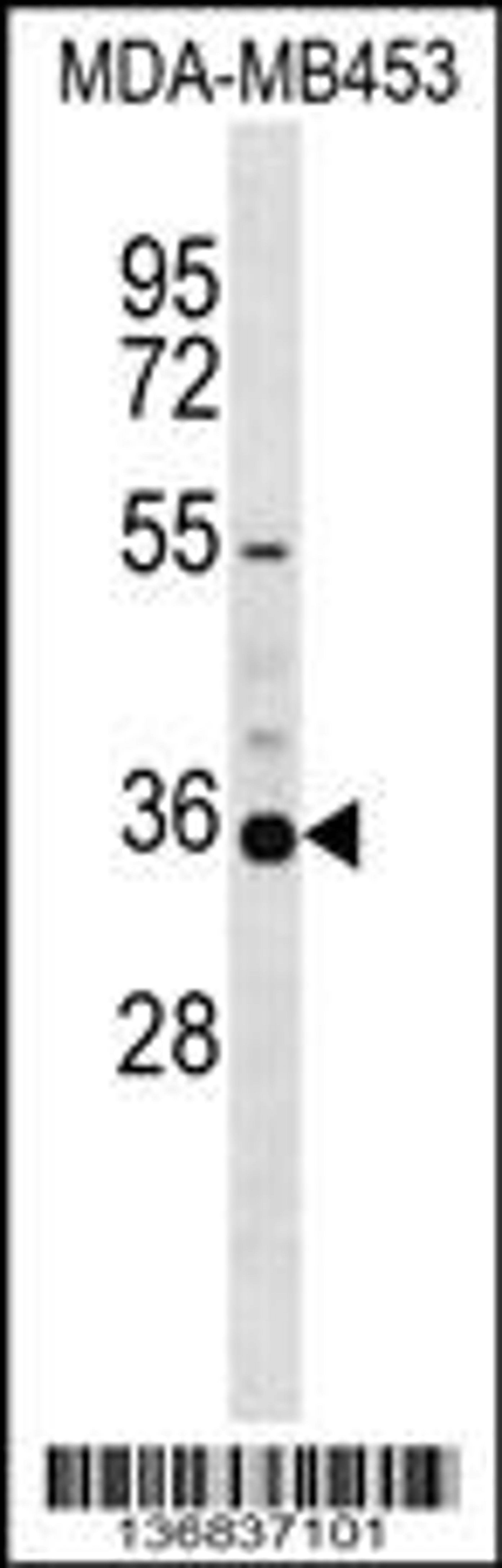 Western blot analysis in MDA-MB453 cell line lysates (35ug/lane).