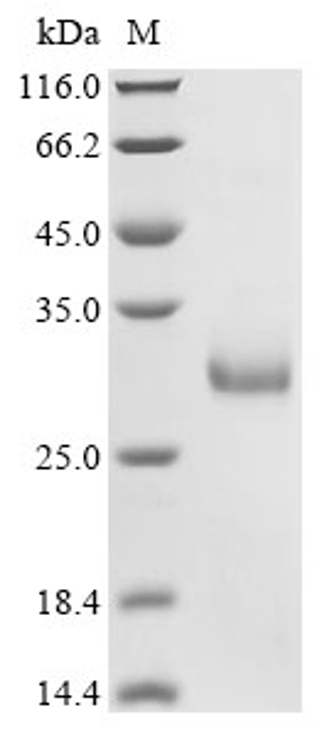 (Tris-Glycine gel) Discontinuous SDS-PAGE (reduced) with 5% enrichment gel and 15% separation gel.