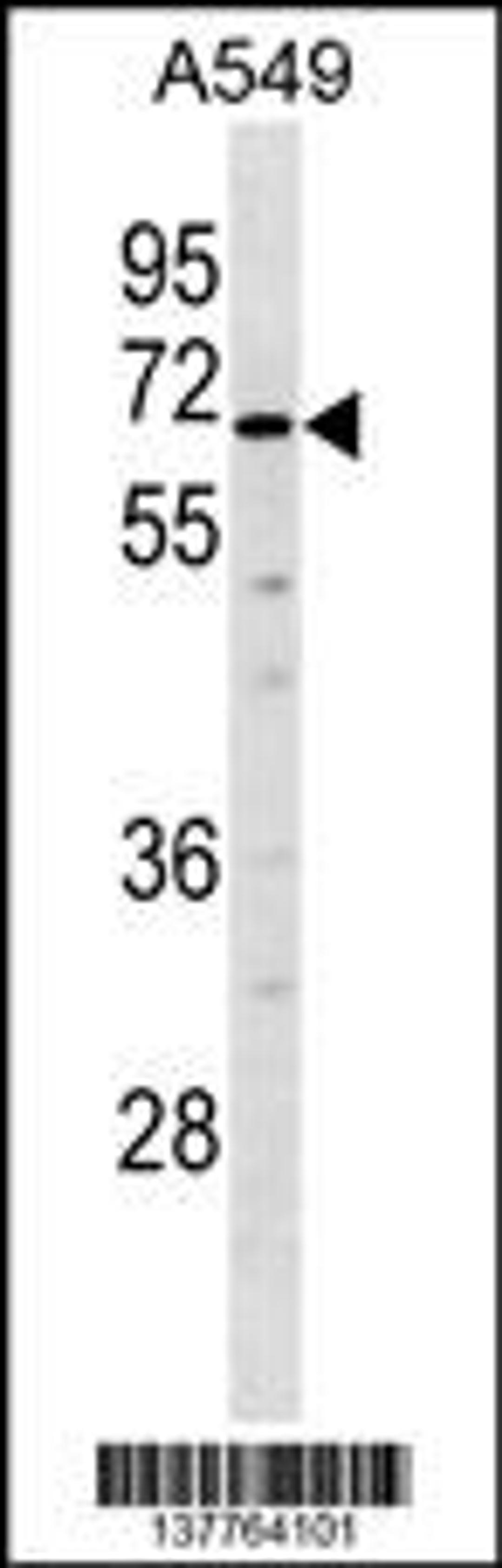 Western blot analysis in A549 cell line lysates (35ug/lane).