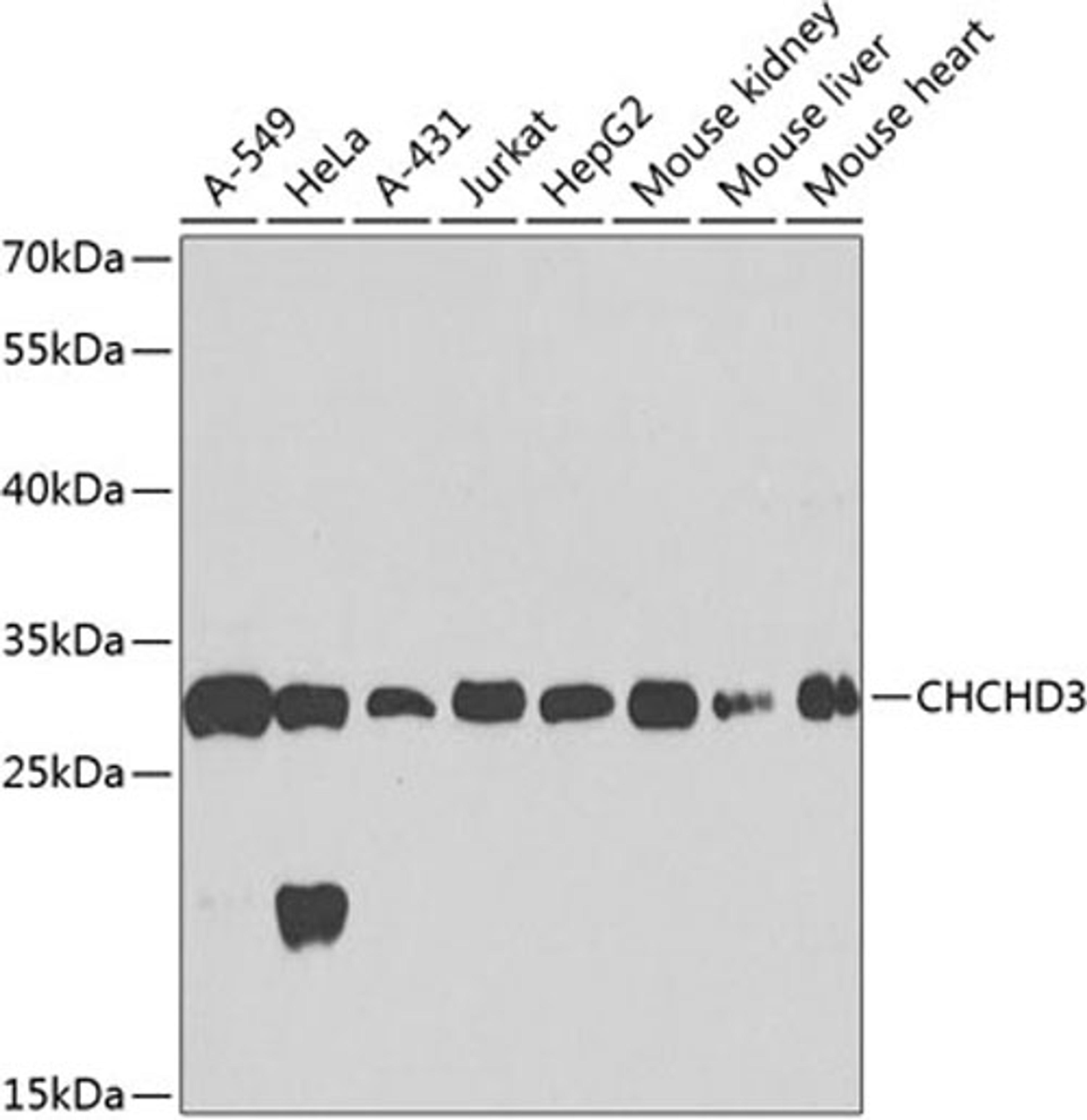 Western blot - CHCHD3 antibody (A8584)