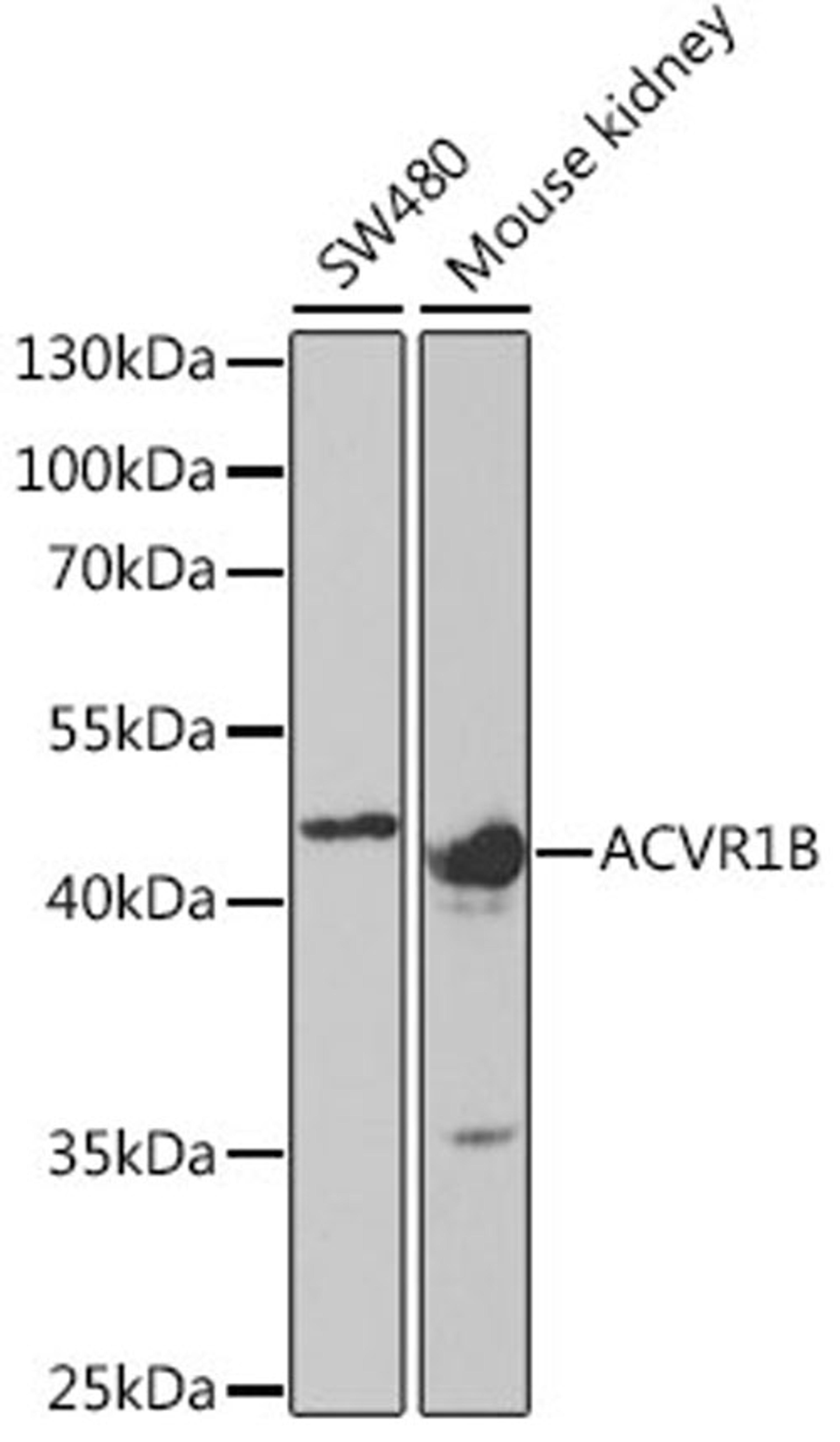 Western blot - ACVR1B antibody (A5453)