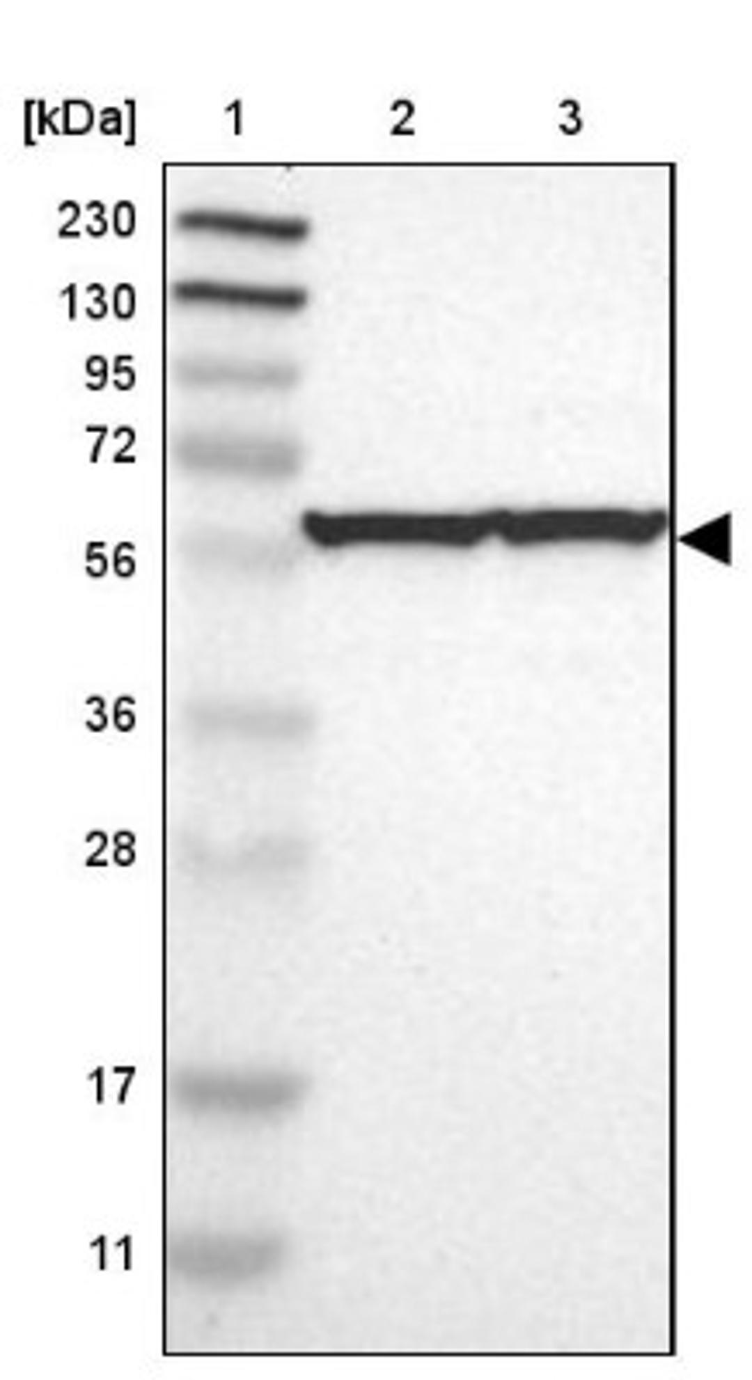 Western Blot: TCP1-eta Antibody [NBP1-88144] - Lane 1: Marker [kDa] 230, 130, 95, 72, 56, 36, 28, 17, 11<br/>Lane 2: Human cell line RT-4<br/>Lane 3: Human cell line U-251MG sp