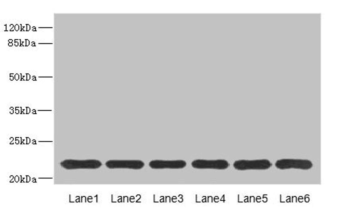 Western blot. All lanes: SAR1A antibody at 4.57ug/ml. Lane 1: Mouse lung tissue. Lane 2: NIH/3T3 whole cell lysate. Lane 3: A431 whole cell lysate. Lane 4: MCF-7 whole cell lysate. Lane 5: Jurkat whole cell lysate. Lane 6: HepG2 whole cell lysate. Secondary. Goat polyclonal to rabbit IgG at 1/10000 dilution. Predicted band size: 23, 18 kDa. Observed band size: 23 kDa. 