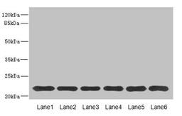 Western blot. All lanes: SAR1A antibody at 4.57ug/ml. Lane 1: Mouse lung tissue. Lane 2: NIH/3T3 whole cell lysate. Lane 3: A431 whole cell lysate. Lane 4: MCF-7 whole cell lysate. Lane 5: Jurkat whole cell lysate. Lane 6: HepG2 whole cell lysate. Secondary. Goat polyclonal to rabbit IgG at 1/10000 dilution. Predicted band size: 23, 18 kDa. Observed band size: 23 kDa. 