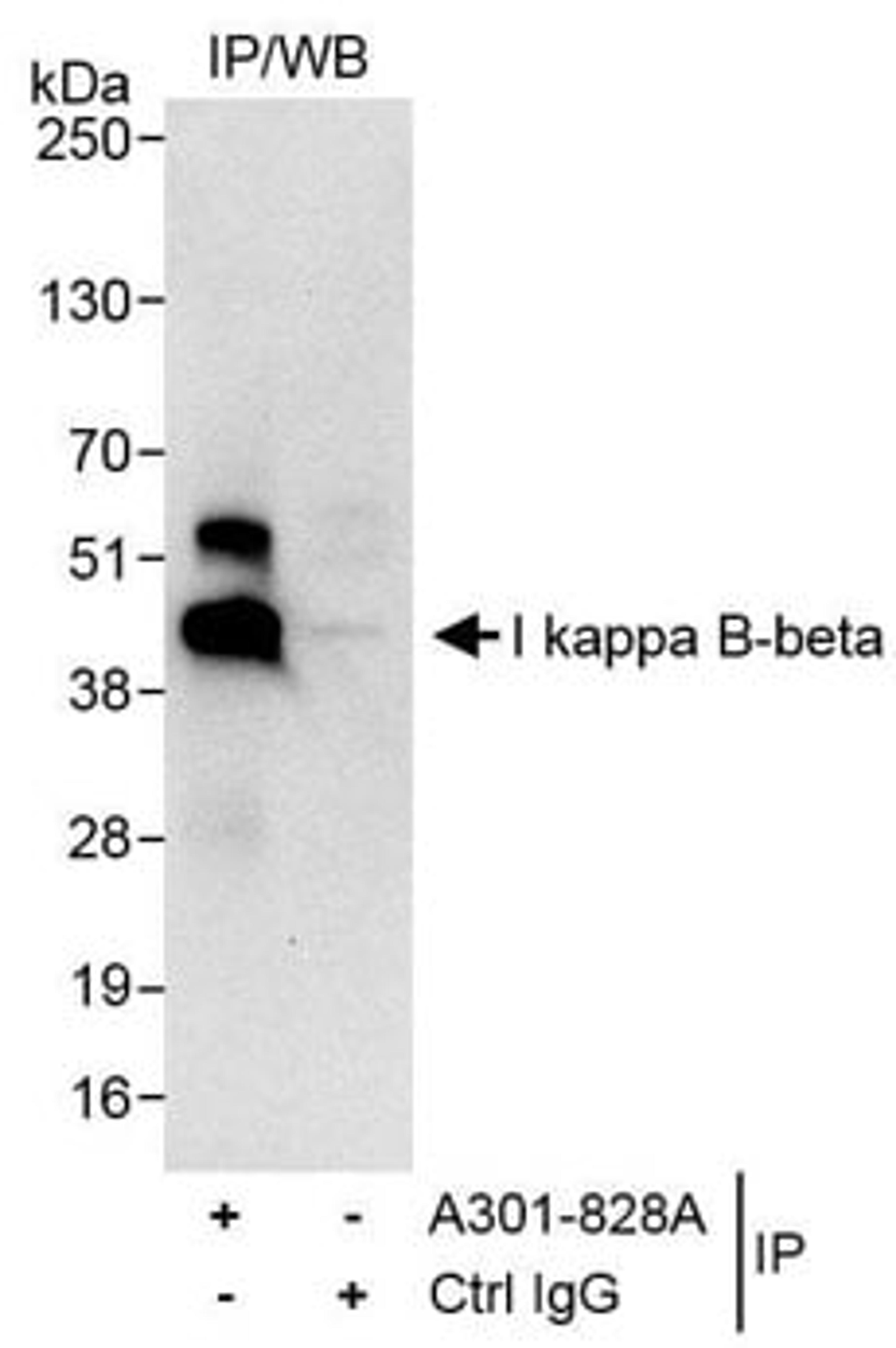 Detection of human I kappa B-beta by western blot of immunoprecipitates.