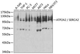 Western blot - ATP2A2 / SERCA2 antibody (A1097)