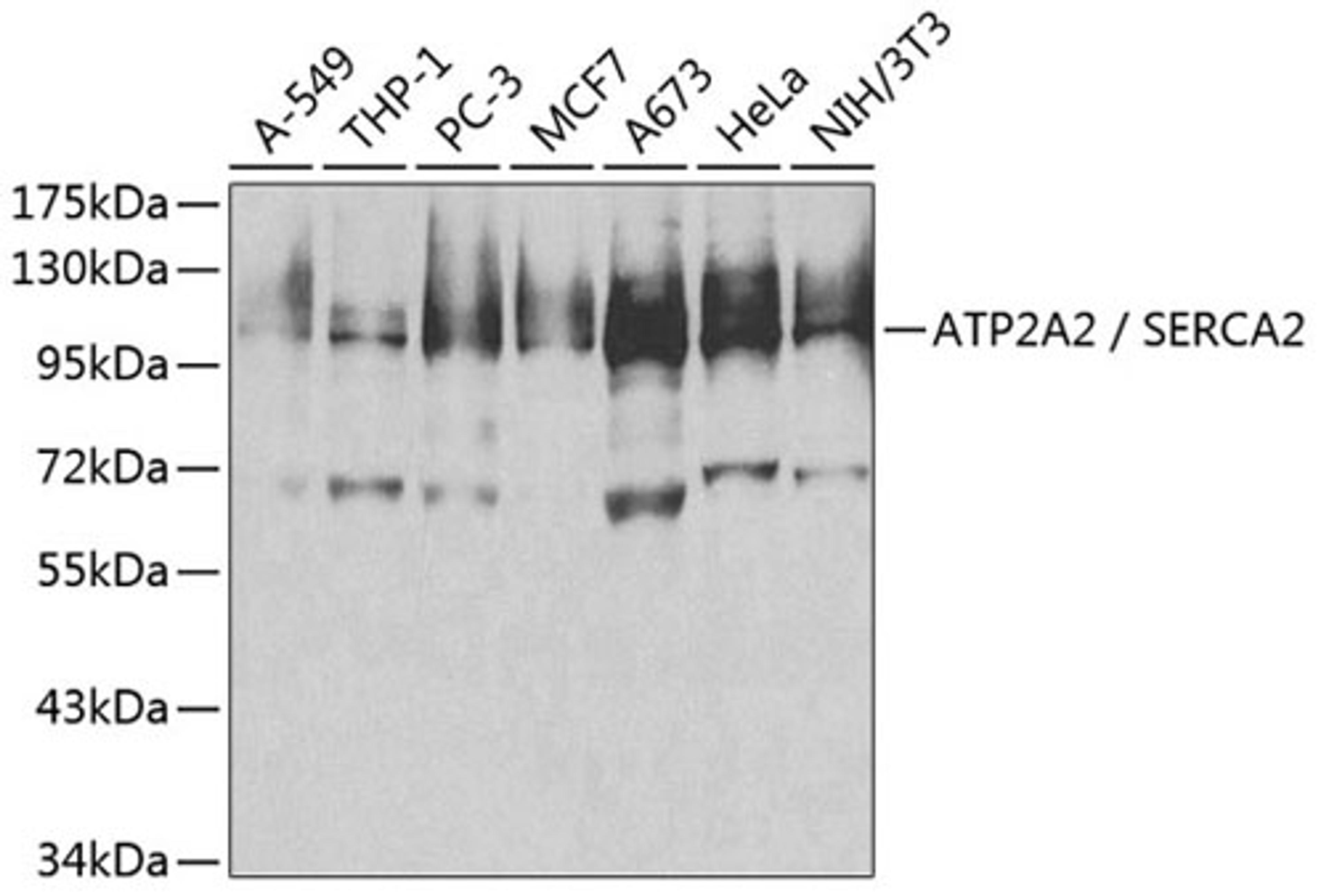 Western blot - ATP2A2 / SERCA2 antibody (A1097)