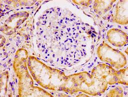 IHC image of CSB-PA888001LA01HU diluted at 1:100 and staining in paraffin-embedded human kidney tissue performed on a Leica BondTM system. After dewaxing and hydration, antigen retrieval was mediated by high pressure in a citrate buffer (pH 6.0). Section was blocked with 10% normal goat serum 30min at RT. Then primary antibody (1% BSA) was incubated at 4°C overnight. The primary is detected by a biotinylated secondary antibody and visualized using an HRP conjugated SP system.