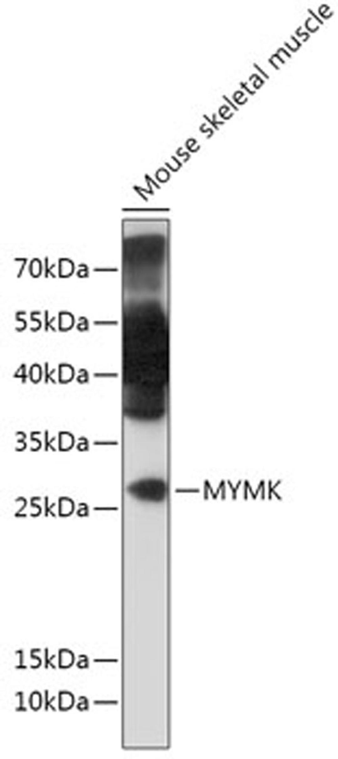 Western blot - MYMK antibody (A18158)